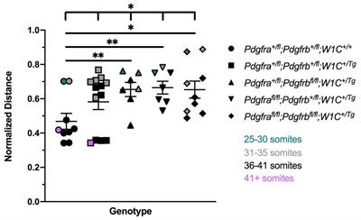 Pdgfra and Pdgfrb Genetically Interact in the Murine Neural Crest Cell Lineage to Regulate Migration and Proliferation